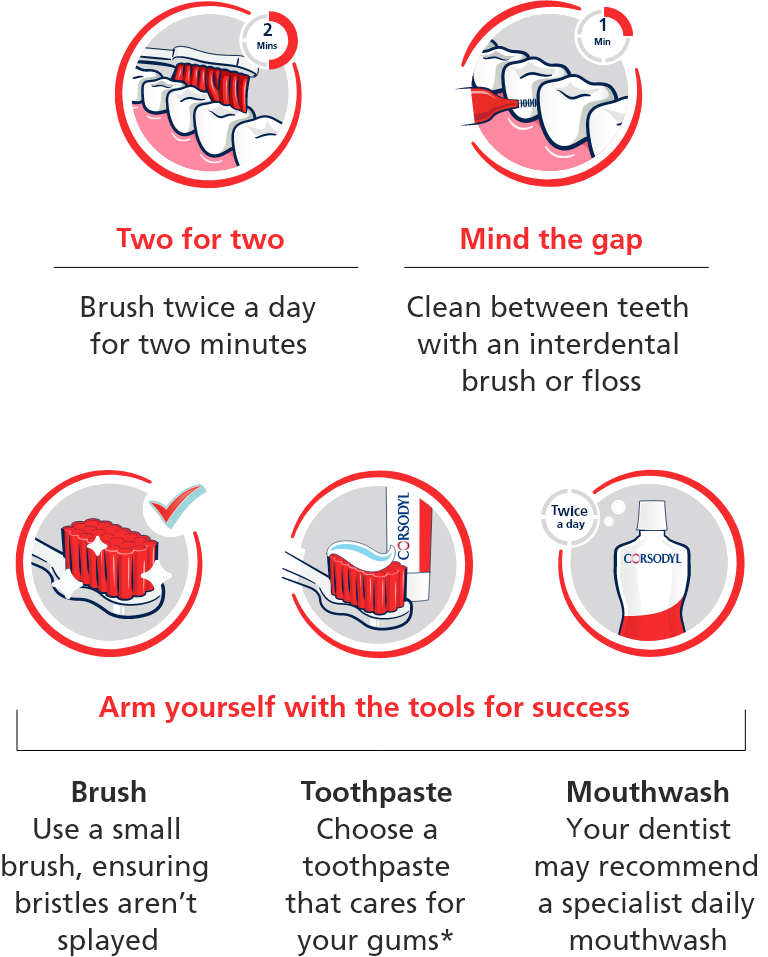 Illustration explaining progression of gum disease
